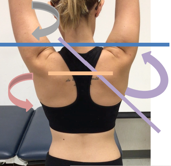 <p>30-60 degrees external rotation</p>