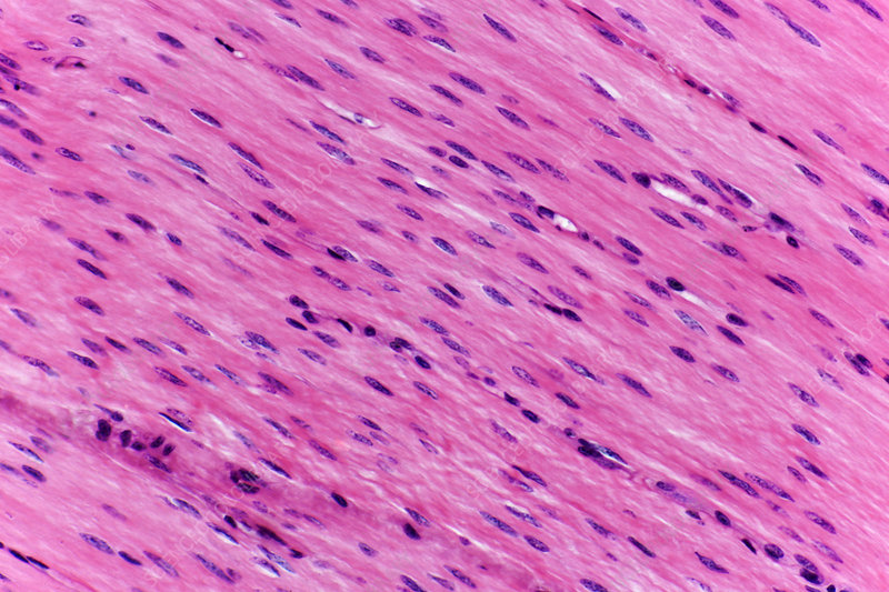 <p>Smooth, Cardiac, or Skeletal tissue?</p>