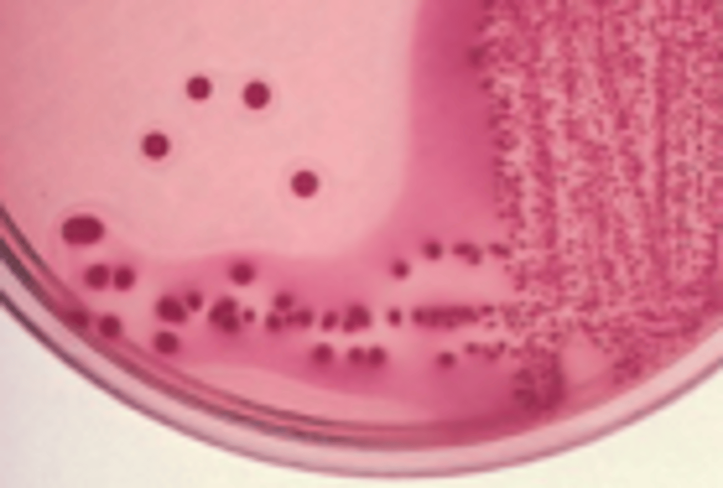 <p>dry, pink colonies; may be LF or NLF, produce a haze in the agar</p>