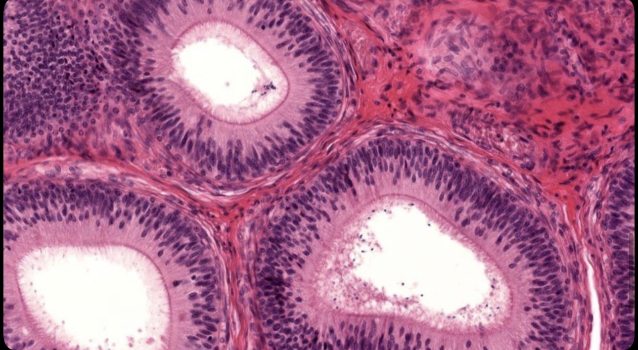 <p>Células epiteliales cilíndricas con microvellosidades largas</p>