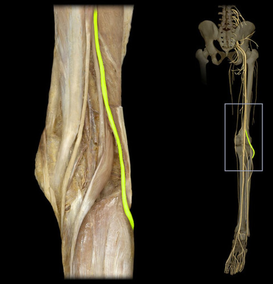 <p>Branch of the sciatic nerve wrapping around the fibular head. Innervates the anterolateral leg and foot.</p>