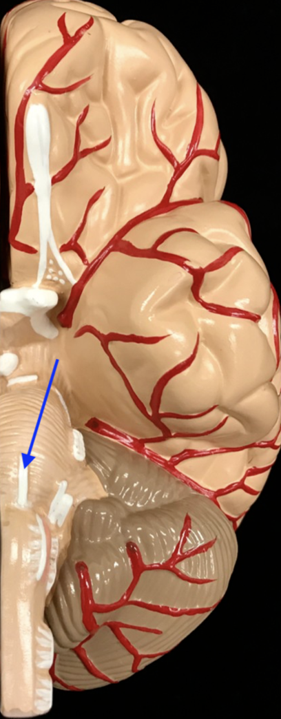 <p>What is the cranial nerve and roman numeral?</p>