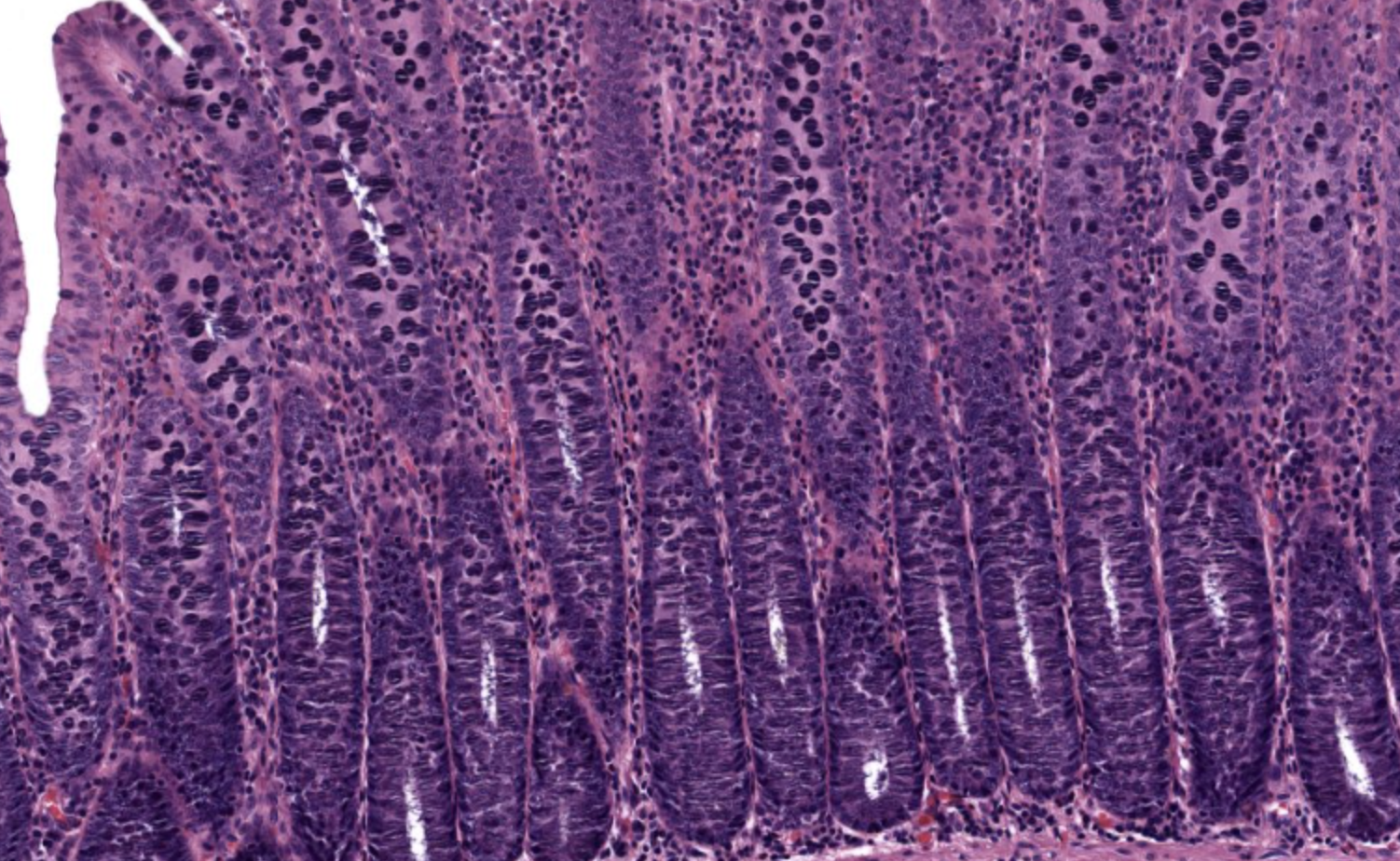 <p>Mucosa in Colon</p>