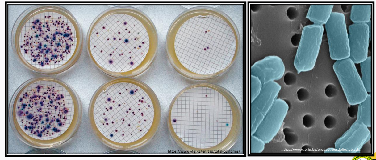 <p>Membrane Filter Technique</p>