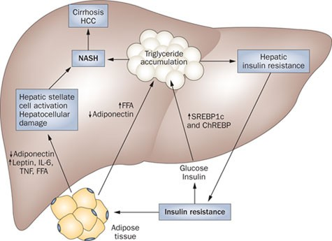 <p>Vid steatos kommer både inflödet och hepatocellulär omsättning av fett att vara förändrat. Högt fettintag kan bidra men det är främst perifer insulinresistens som ger ökad lipolys. Hyperinsulinemi och hyperglykemi ger aktivering av SREBP och ChREBP (transkriptionsfaktorer) → ökad lipogenes och minskad betaoxidation. Hyperinsulinemi kan även minska apoB vilket ger mindre utsöndring av VLDL från levern. </p><p>En förändrad mikrobiota med mindre variation kan leda till barriärskda → minskad produktion av <strong>butyratsyra</strong> → ökad mängd sekundära gallsalter som hämmar <strong>FXR</strong> (FXR förhindrar insulinresisten, glukoneogenes och minska triglyceremi) → ökad syntes av gallsyra.</p><p>Steatosen kan utvecklas till<strong> steatohepatit (MASH/NASH)</strong> som är en inflammation pga steatosen (20%). Det finns en koppling mellan förekomst av PAMPs i levern och steatos.</p>