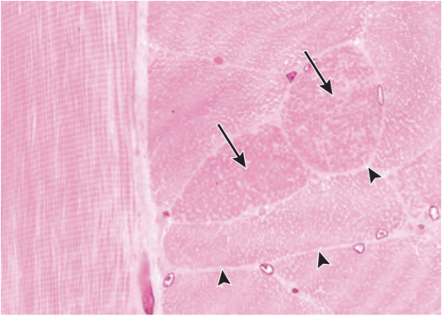 <p>For the muscle fibers shown in the image, which of the following terms describes the pink-stained dots visible in cross sections, and the longitudinal lines visible in longitudinal sections?</p><p>(A) A bands</p><p>(B) Myofibrils</p><p>(C) Myofilaments</p><p>(D) Myosins</p><p>(E) Thin filaments</p>
