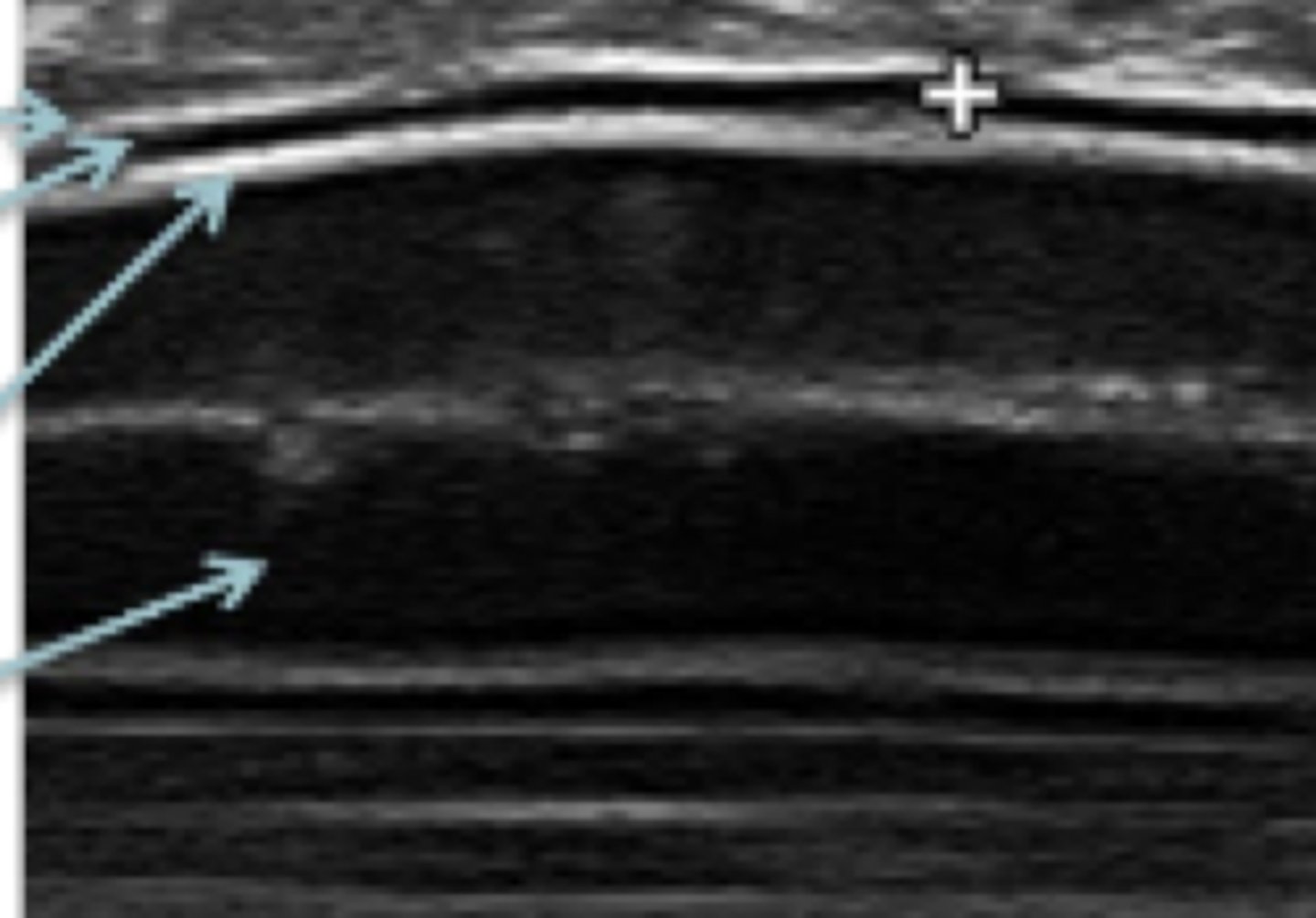 <p>¿qué parte del cuerpo?</p>