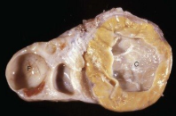 <p>What is this condition?</p>