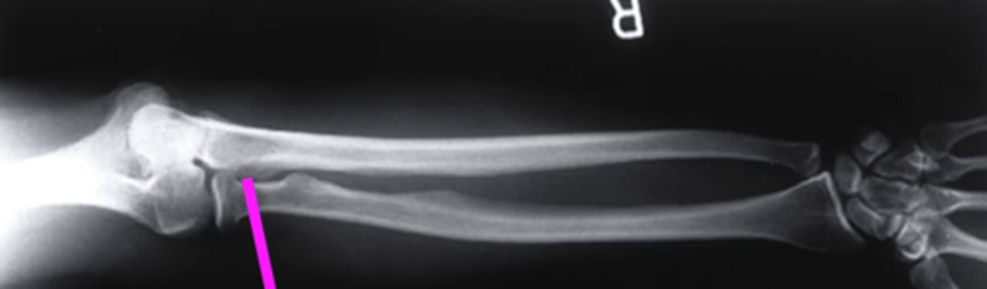 <p>what does this pink line point to?</p>