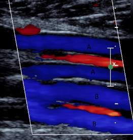 <p>what does B represent in this image</p>