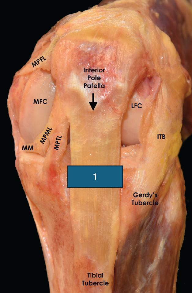term image