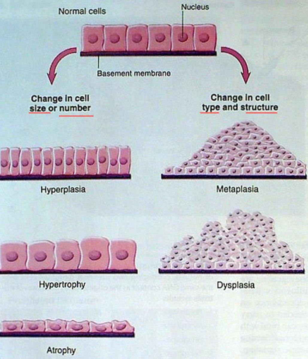 <p>increase in number of cells</p>