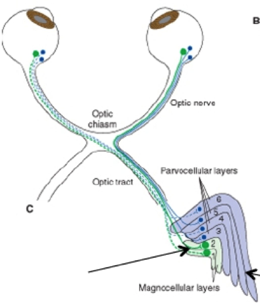 <p>lesion here reduces ability to perceive rapidly changing stimuli</p>