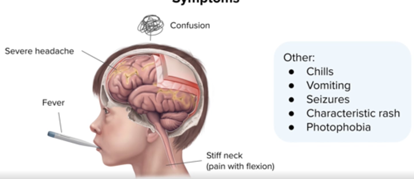 <p>high fever,</p><p>Severe headache</p><p>stiff neck</p><p>altered mental status</p><p>rash (nisseria only)</p>