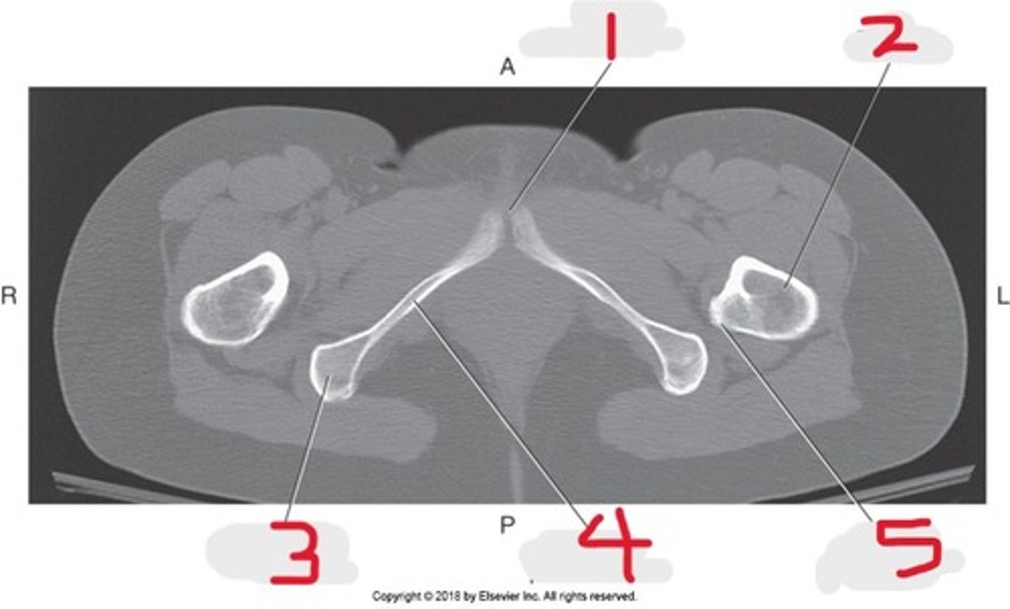 <p>Name all numbered structures</p>