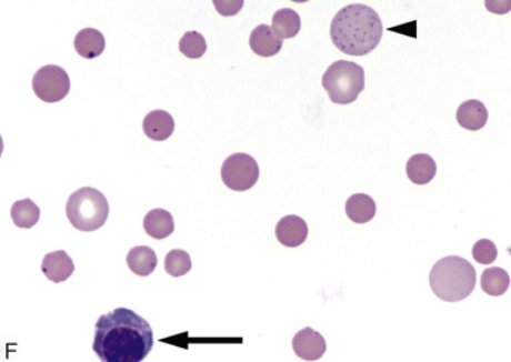 <p>what type of RBC abnormality is this</p>