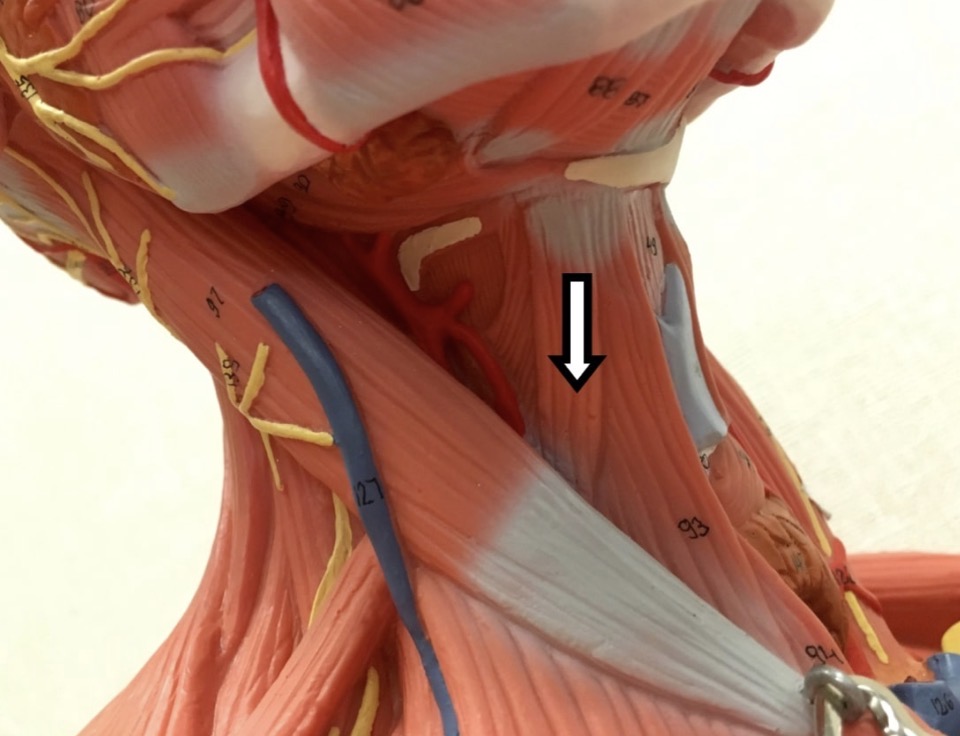 <p><span>Name the muscle labeled with the white arrow below:</span></p>