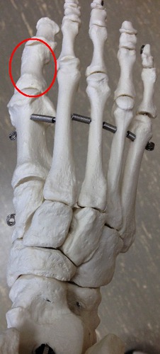 Identify this bone.
