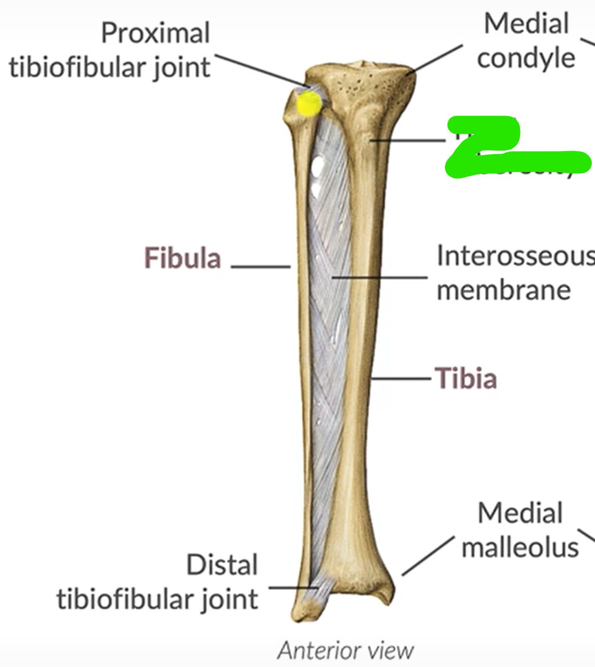 term image