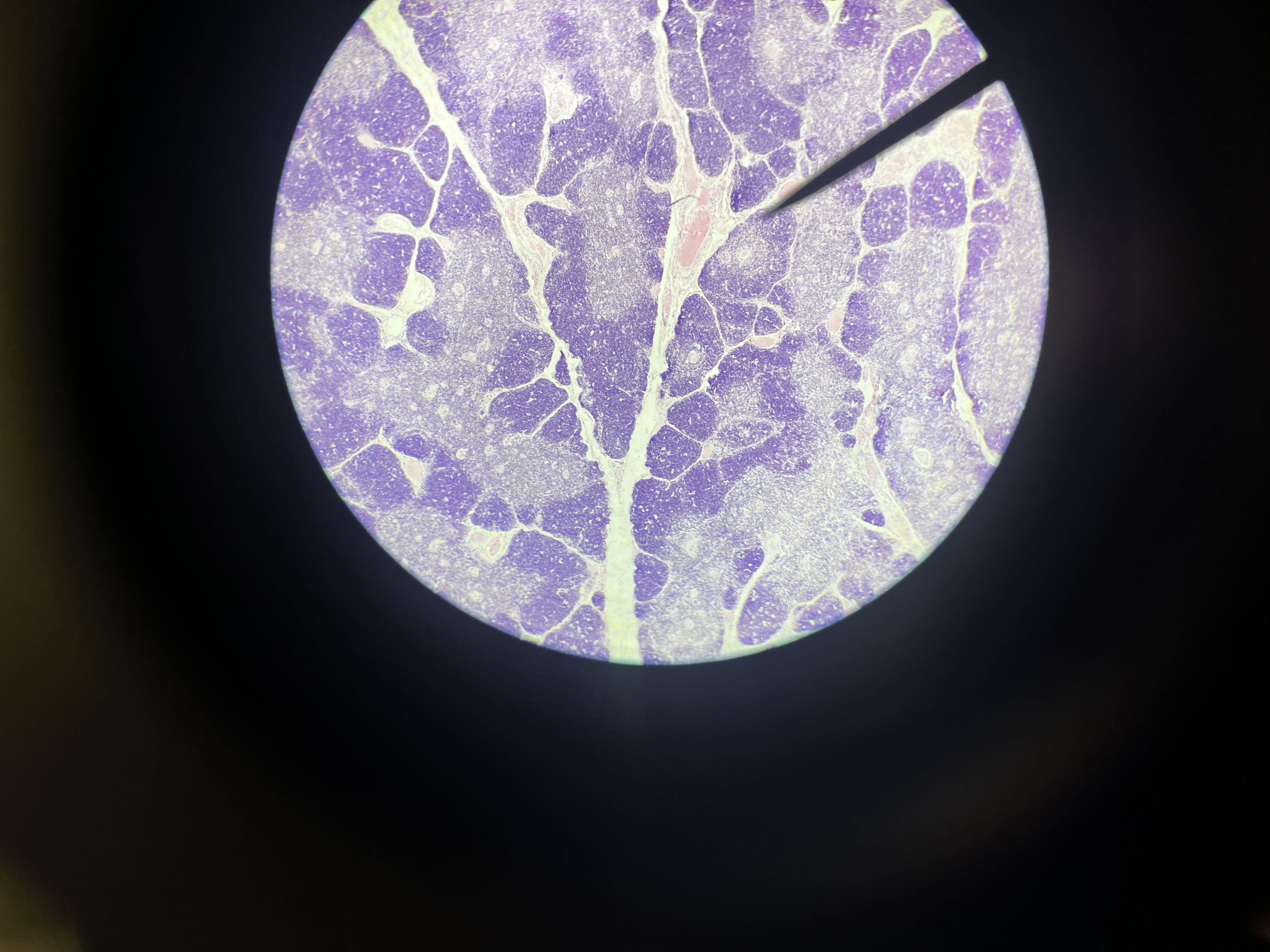<p>What lymphoid organ is this</p>