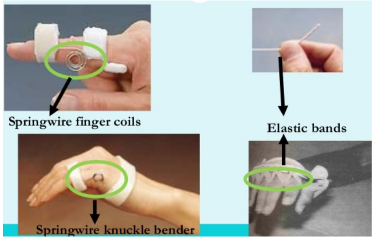 <p>Name this component of a dynamic splint. What’s its function?</p>