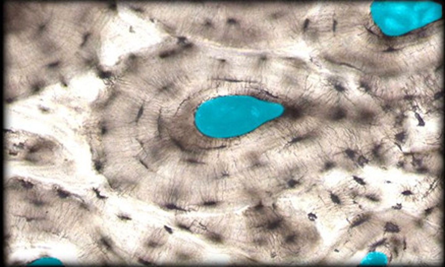 <p>Channels in bone that contain blood vessels and nerves</p><p>note: these are the black parts in the image</p>