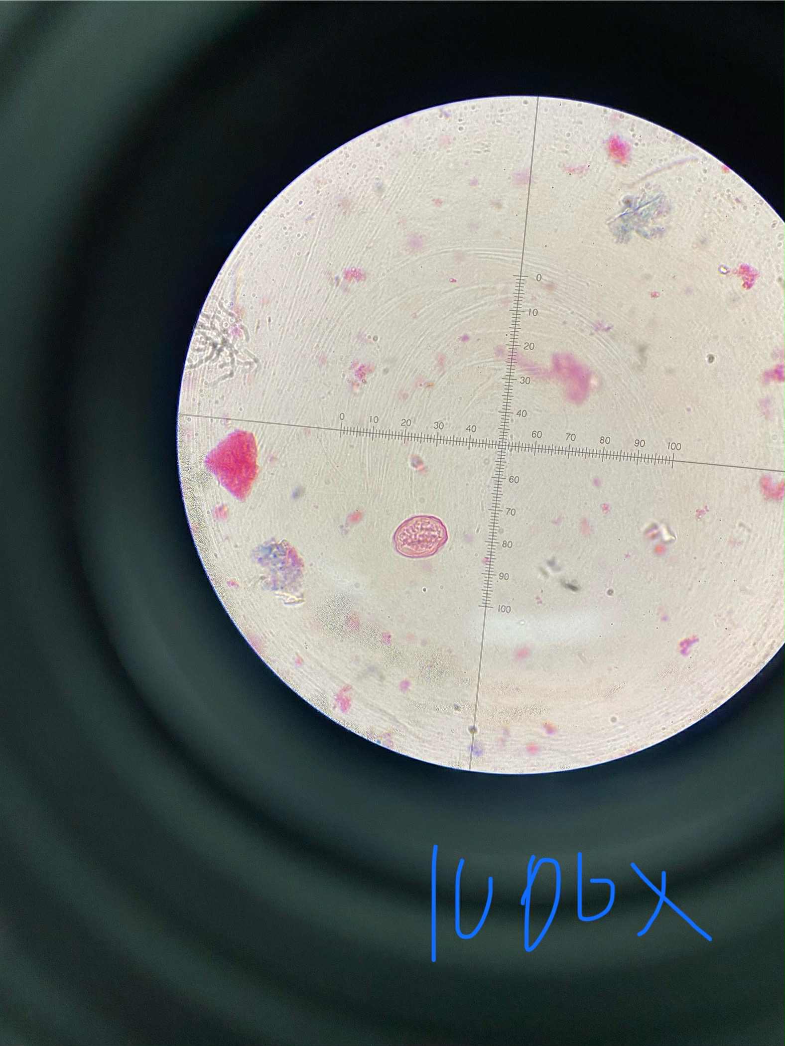 <p>specimen</p><p>phylum</p><p>color</p><p>shape</p><p>cell arrangement</p><p>motility</p><p></p><p>found</p><p></p><p>disease</p><p>prevention</p><p>treatment</p><p></p><p>life cycle</p><p></p>