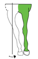 <p>adduction</p>