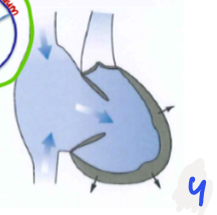 <p>Entspannung des Herzmuskels => Herz wird grösser durch Elastizität </p><p>Wenn Druck in Kammern tiefer als im Vorhof => Öffnung der <strong>Segelklappen</strong>, die Kammern füllen sich</p>