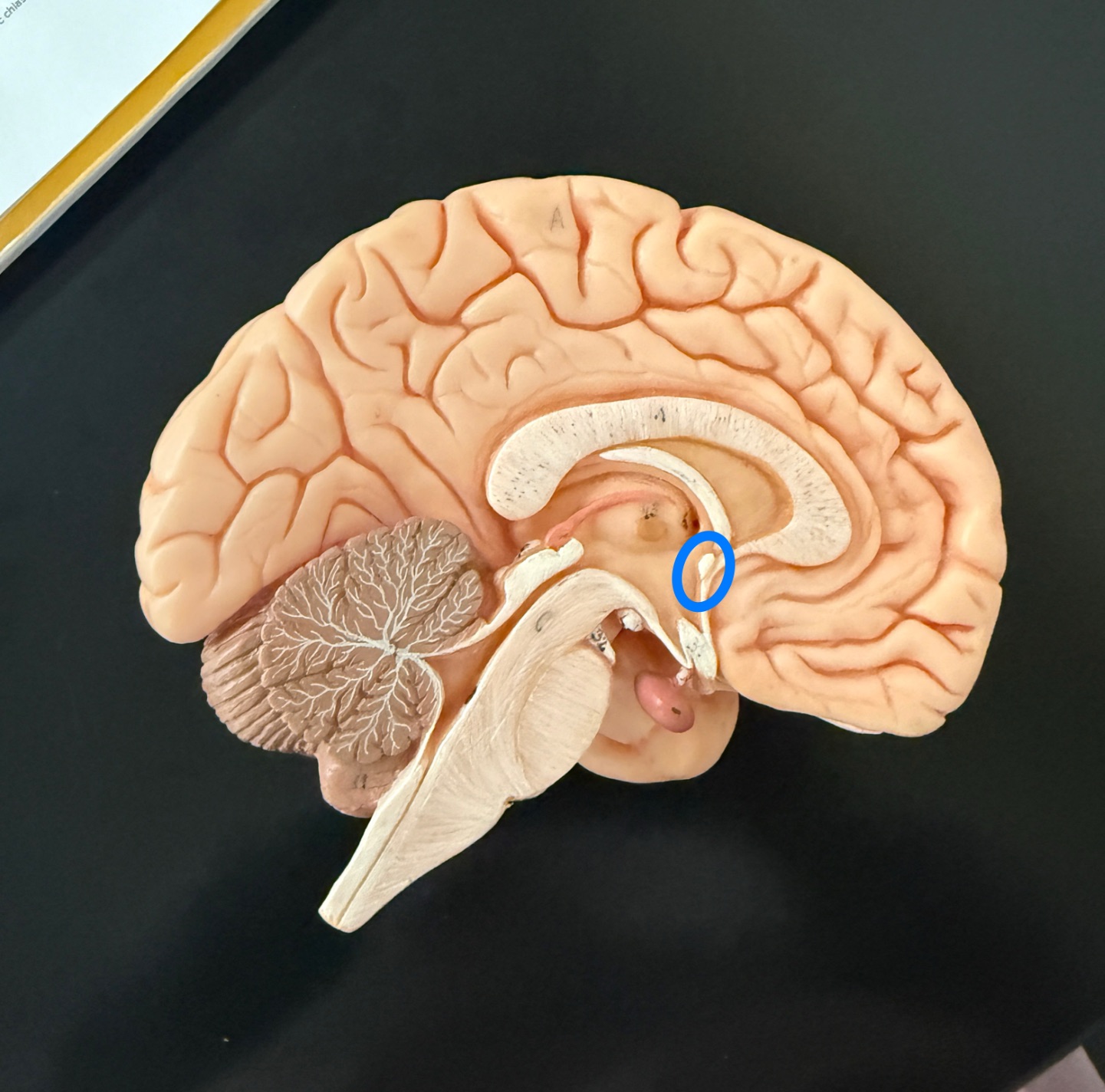 <p>What is outlined in blue on the brain model?</p>