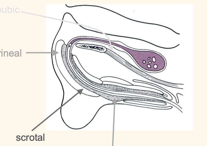 <ul><li><p>prepubic x</p></li><li><p>perineal (uncommon)</p></li><li><p>prescrotal (too much vasculature, thin urethra)</p><p></p></li></ul><p><mark data-color="red" style="background-color: red; color: inherit">SCROTAL REGION is the most common</mark></p><p></p>