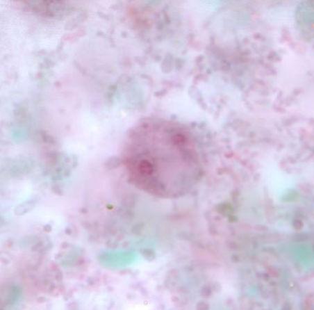 <ul><li><p style="text-align: justify;"><span style="background-color: transparent;"><span>Identify the organism. Give genus and species.</span></span></p><ul><li><p style="text-align: justify;">(1)</p></li></ul></li><li><p style="text-align: justify;"><span style="background-color: transparent;"><span>What is the morphologic stage of the organism?</span></span></p><ul><li><p style="text-align: justify;">(2)</p></li></ul></li><li><p style="text-align: justify;"><span style="background-color: transparent;"><span>What feature accomplishes the organism’s progressive motility?</span></span></p><ul><li><p style="text-align: justify;">(3)</p></li></ul></li></ul><p></p>