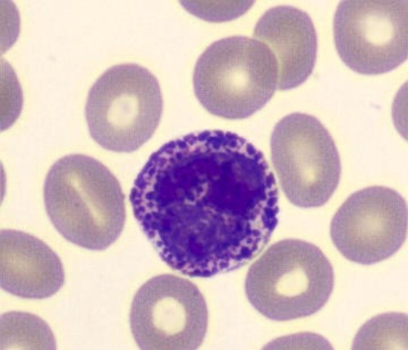 <p>dark purple and obscure the background of the cytoplasm and the nucleus. They contain peroxidase and are positive for periodic acid-Schiff stain (PAS)</p>