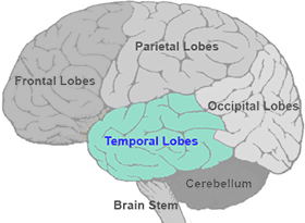 <p>The part of the brain located on the sides, above the ears.</p>