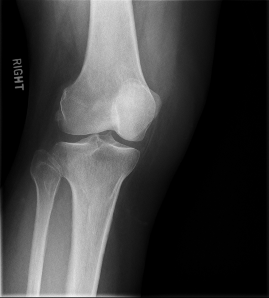 <p>what is the critique of this medial oblique?</p>