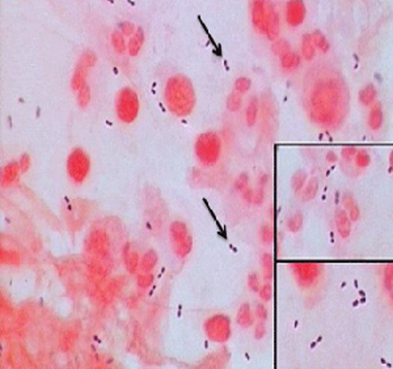 <p>pneumococcus</p>