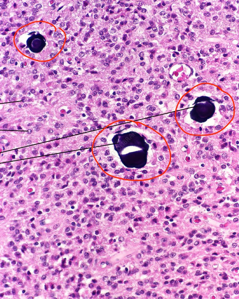 <p>What are the black structures</p>