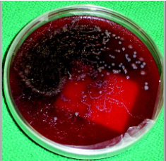 <ul><li><p>Look for rhabditiform larvae in concentrated fecal specimens</p><ul><li><p>Must differentiate from hookworm larvae</p></li></ul></li><li><p><strong><u>Very rarely will you ever see eggs</u></strong></p><ul><li><p>Would indicate hyper-infection</p></li></ul></li><li><p>May see "trails" on your stool culture agar plates--result of migrating larvae from the stool thru the bacterial colonies</p></li></ul><p></p>