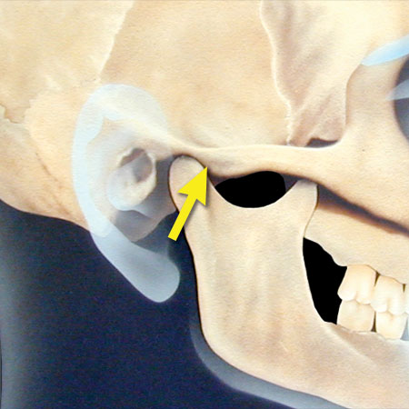 <p>what is this, its description and its appearance on images</p>