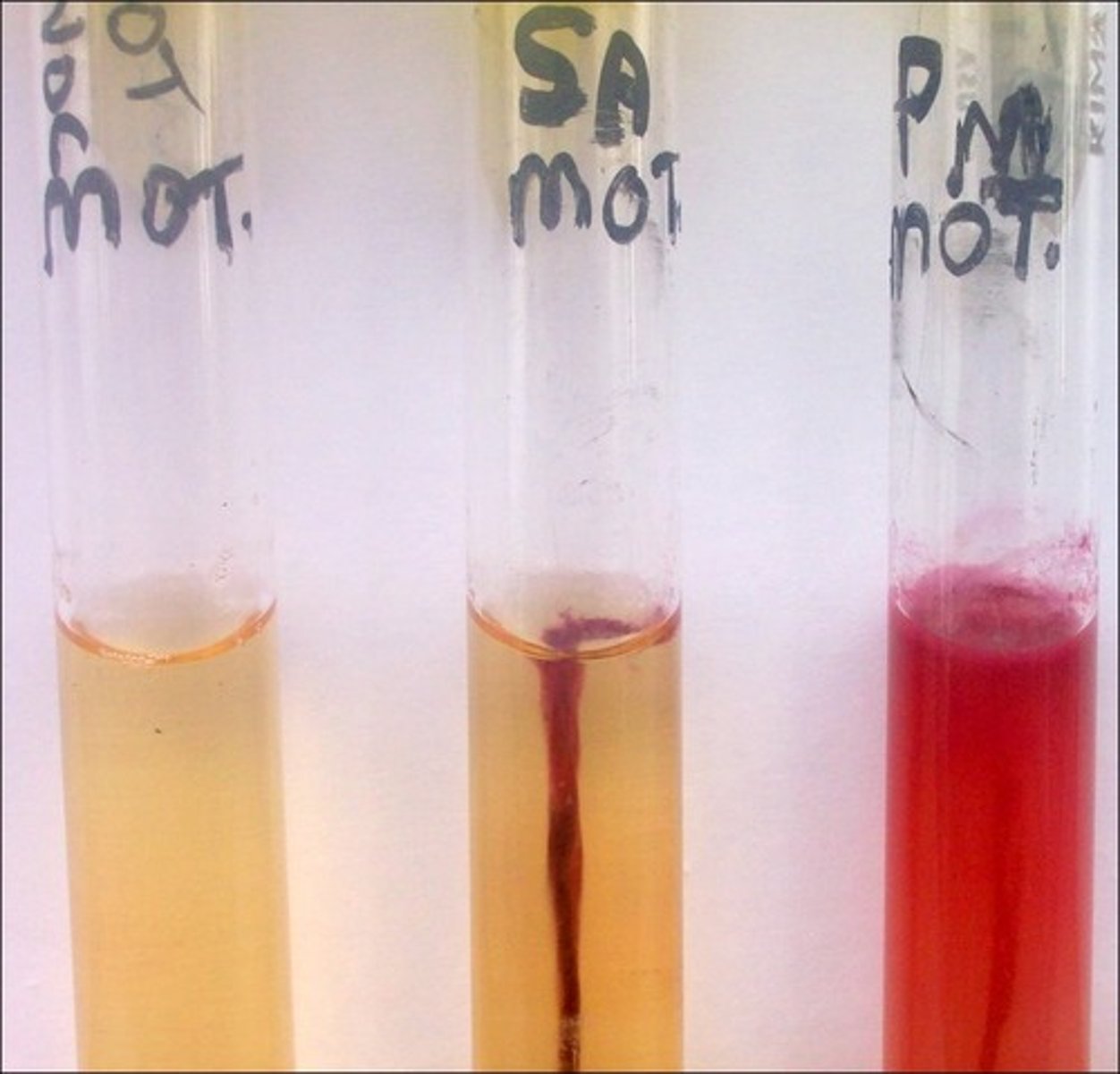 <p>The dye in this procedure is</p>