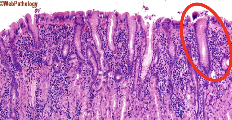 <p>Mucous Neck Cells</p>