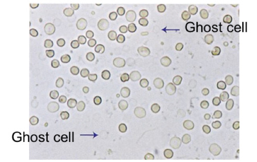<p>cells will absorb water and <strong>swell</strong> which will lyse rapidly causing them to release their hemoglobin and leaving their cell membrane behind → ghost cell is the result</p>