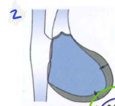 <p>Segelkappen schliessen sich</p><p>Muskulatur der <strong>Kammer kontrahiert</strong> => Druck in Kammern steigt => <strong>Taschenklappen</strong> werden durch zu hohen Druck <strong>aufgeschlossen</strong></p>