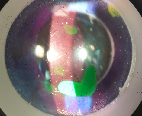 <p>what slit lamp technique is being demonstrated on model eye in this image</p>