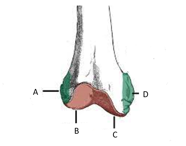 (B)