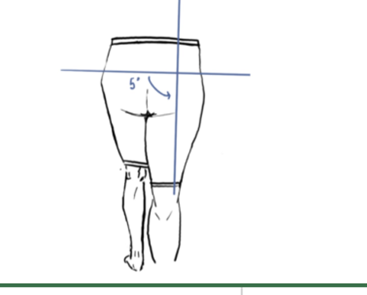 <p>IM: Abduction (Glute medius)</p><p>EM: Adduction</p><p>IM&gt;EM (concentric)</p><p>Angle = 5° abduction</p>