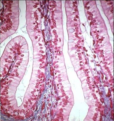 <p>it is simple and columnar, and is used for secretion and absorption </p>