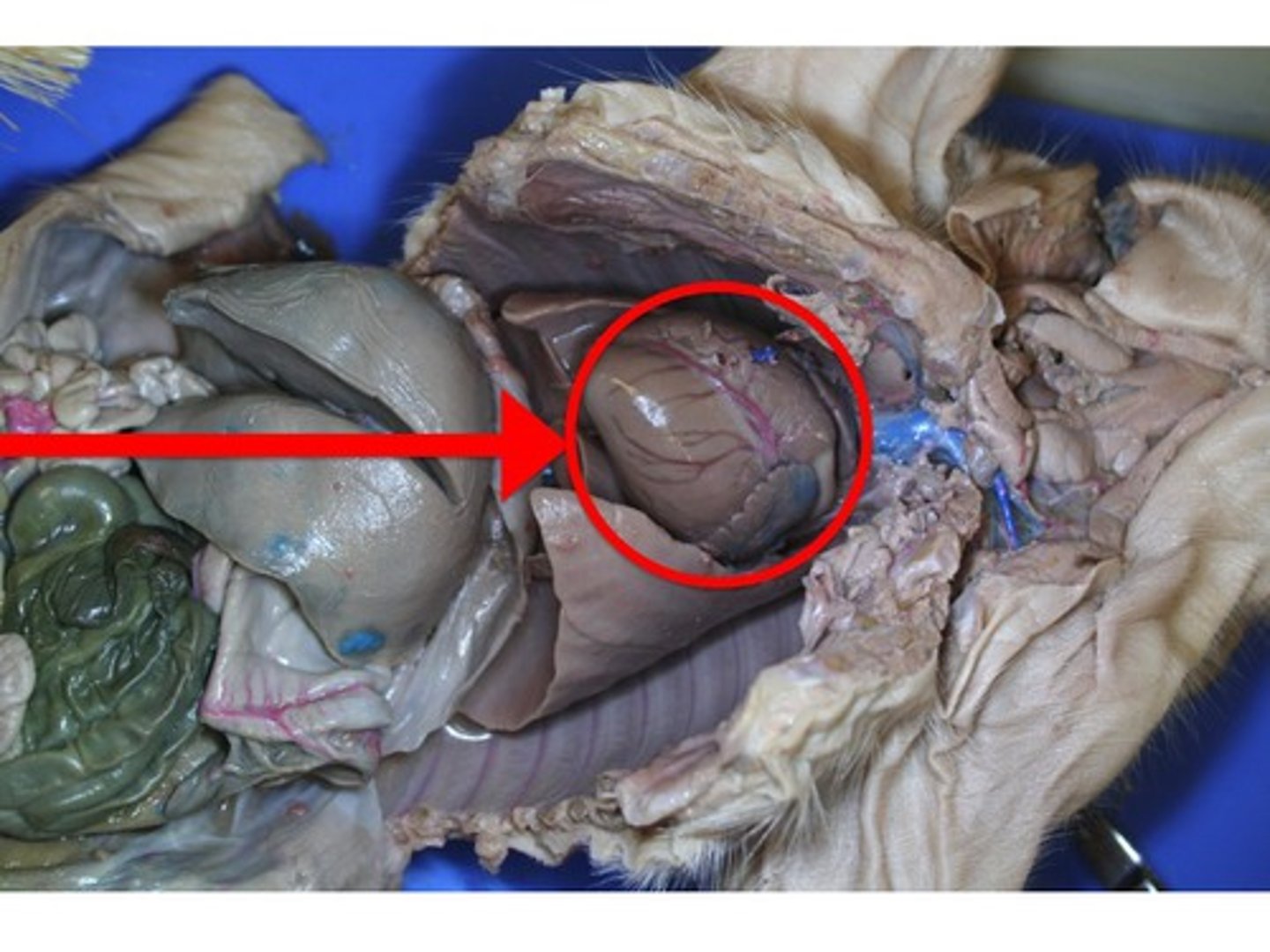 <p>A hollow, muscular organ that pumps blood throughout the body.</p>