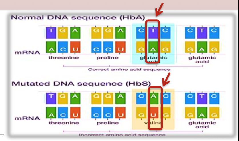 <p>Monogenic disorder caused by an T-to-A point mutation in the 𝛽-globin gene that produces abnormal hemoglobin S (Hb S)</p>