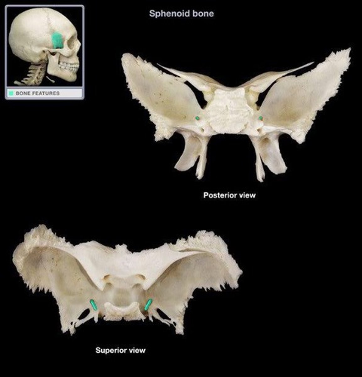 <p>Higher bc maxillary branch of trigemenal moves through it</p>